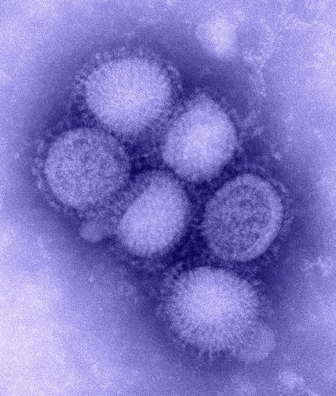 Wirus Świńskiej Grypy - Fot. CDC